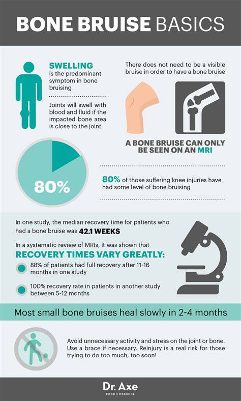 Bone Bruise Recovery Time