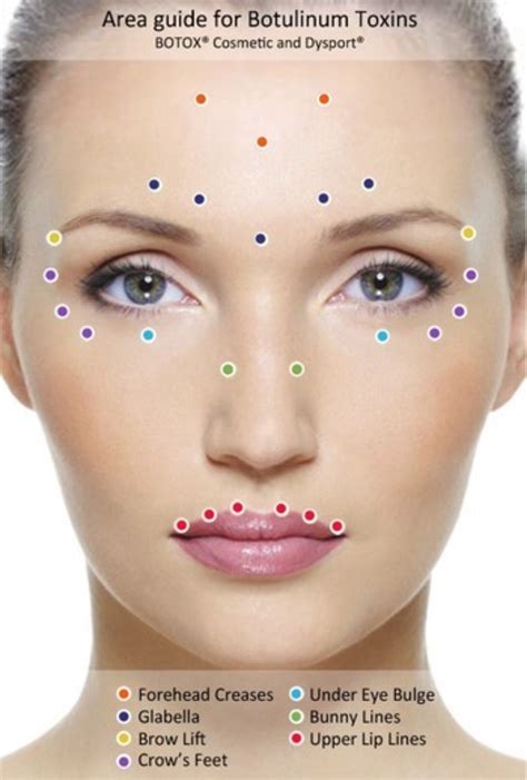 Botox Injection Sites
