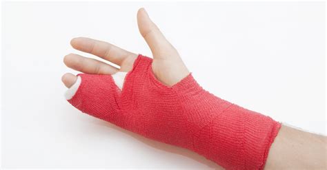 Boxer's Fracture Cast