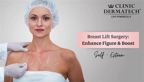 Breast Lift Results