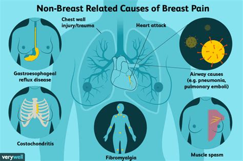 Breast Pain Causes