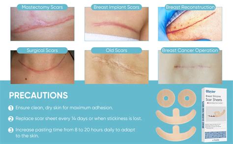 Breast Reduction Scars