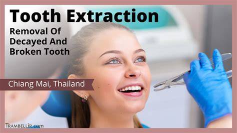 Broken Tooth Removal