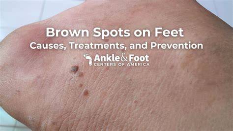 Brown Dots On Skin