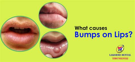 Bump On Lip No Pain