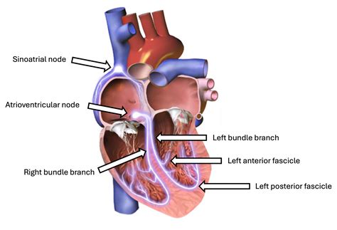 Bundle Branch Blockage