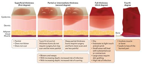 Burn Healing Stages