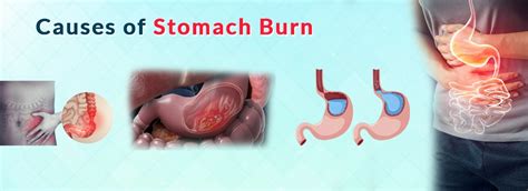 Burning Discomfort In Abdomen
