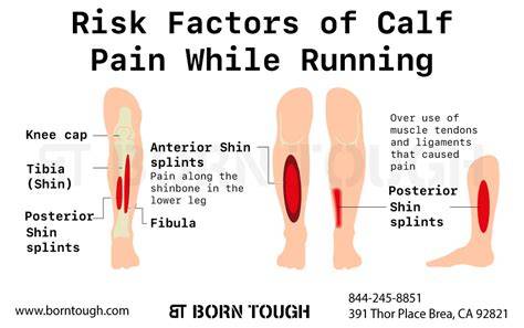 Calf Pain While Running