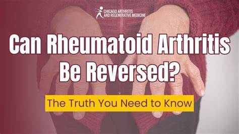 Can Arthritis Be Reversed