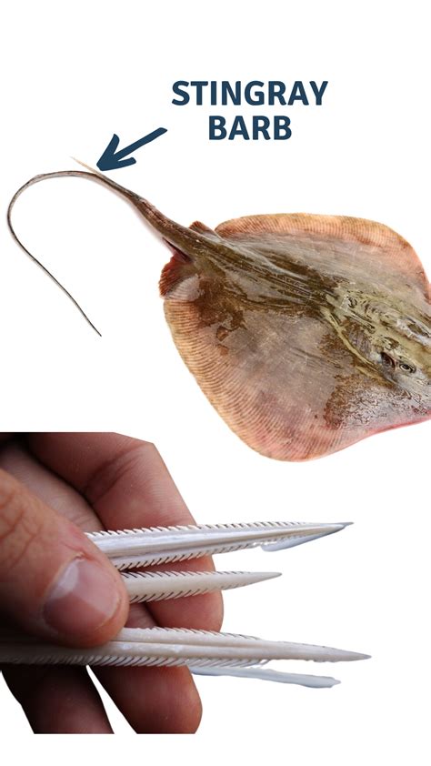 Can Stingray Kill You