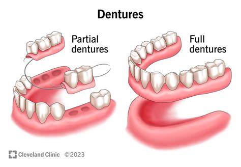 Can You Eat With Partial Dentures