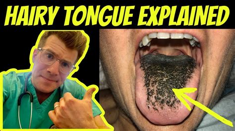 Can You Grow Hair On Your Tongue
