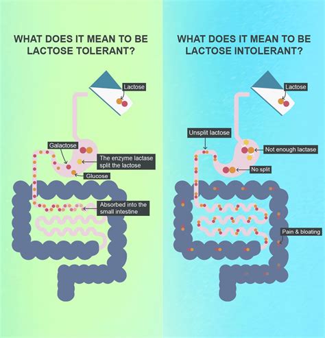 Can You Grow Into Lactose Intolerance