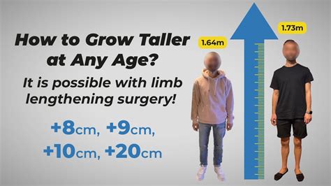 Can You Grow Taller After 20