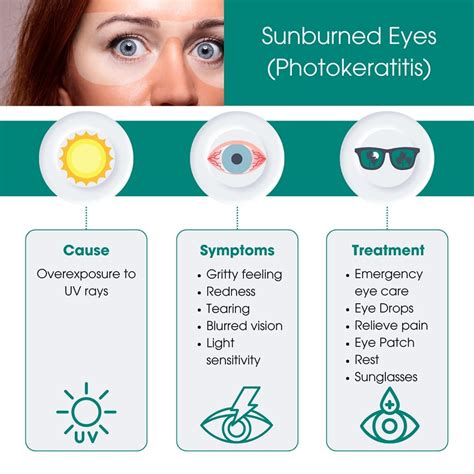 Can Your Eyes Get Sunburned
