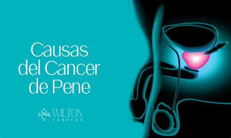 Cancer De Pene