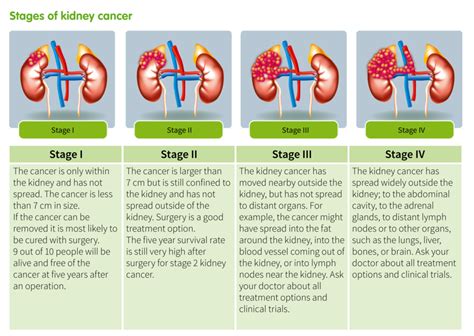Cancer Kidney Stage 4