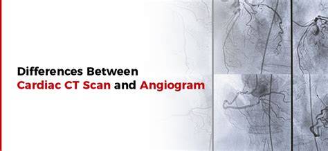 Cardiac Ct Scan Vs Angiogram