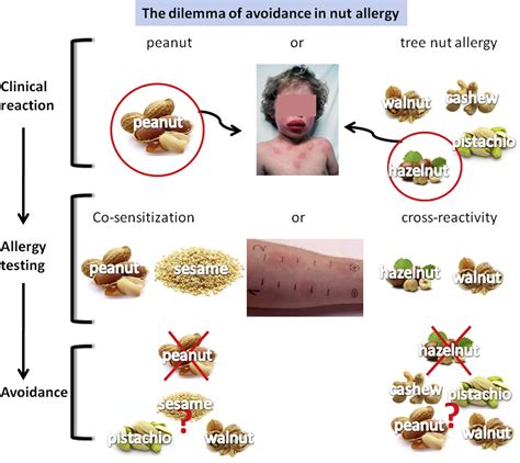 Cashew Nuts Allergic Reaction