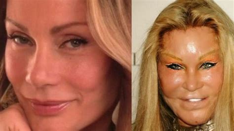 Cat Face Surgery