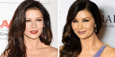 Catherine Zeta Jones Face Surgery