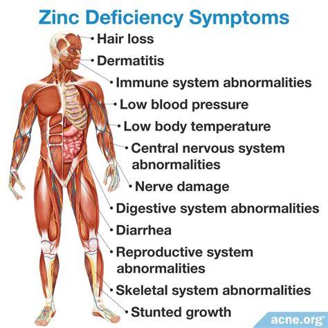Caused By Vs Due To Zinc