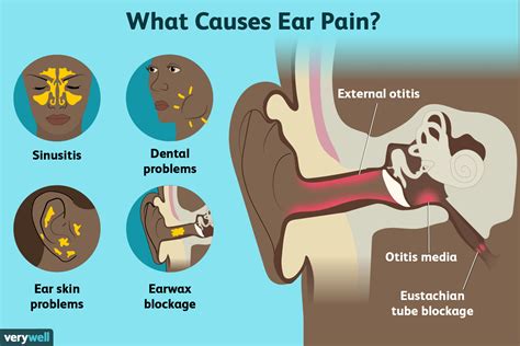 Causes Of Earache