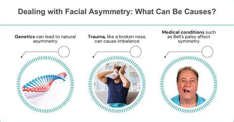 Causes Of Facial Asymmetry