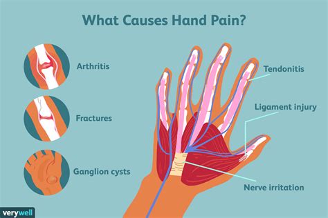 Causes Of Joint Pain In Hands