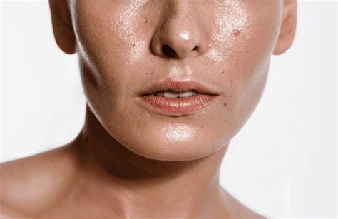 Causes Of Oily Face
