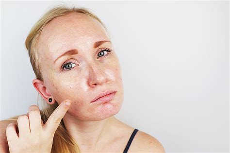Causes Of Sebum Overproduction