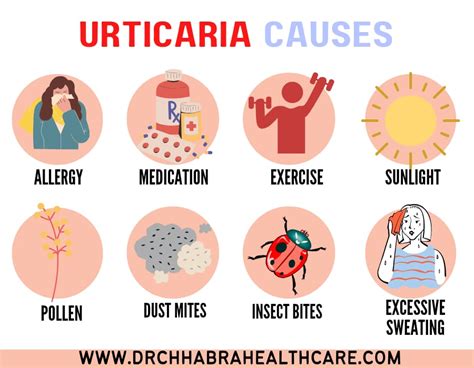 Causes Of Urticaria Rash