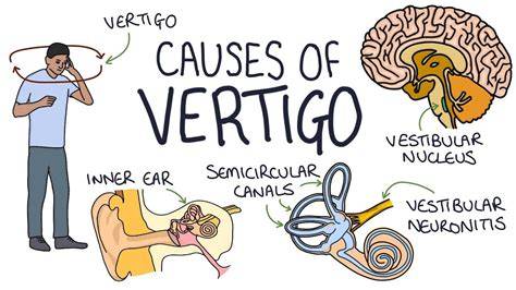 Causes Of Vertigo In Men