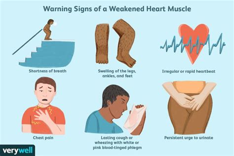 Causes Of Weak Heart