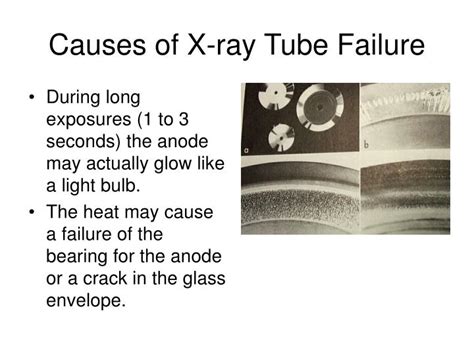 Causes Of X Ray Tube Failure