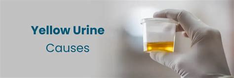 Causes Of Yellow Urine