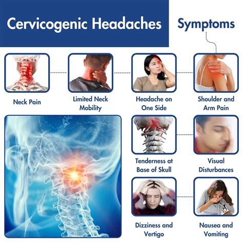 Cervicogenic Headache Treatment At Home