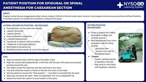 Cesarean Spinal Block
