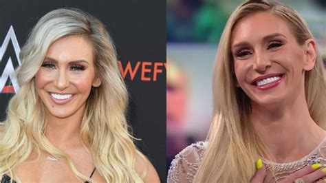 Charlotte Flair Surgery Face