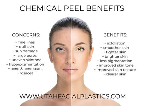 Chemical Peel Advantages