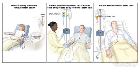 Chemotherapy For Acute Myeloid Leukemia