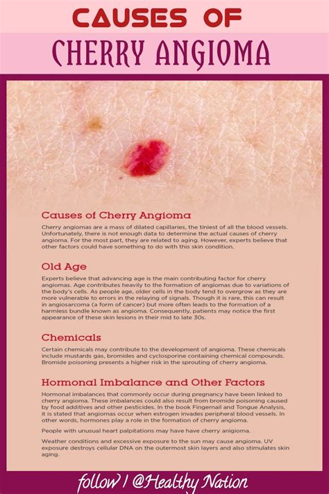 Cherry Angioma On Breast