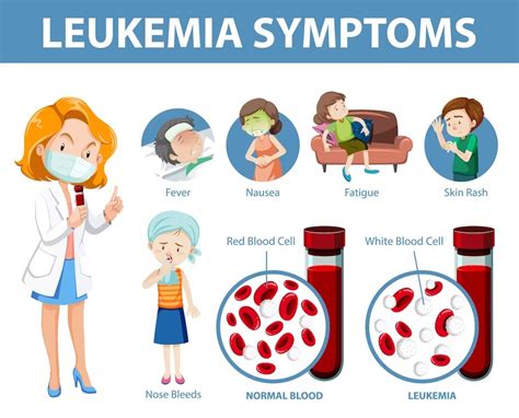 Childhood Leukemia Signs And Symptoms