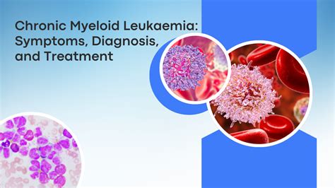 Chronic Leukaemia Diagnosis