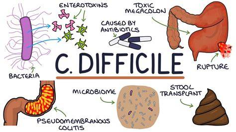 Ciff Diff Symptoms