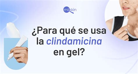 Clindamycin Para Que Sirve