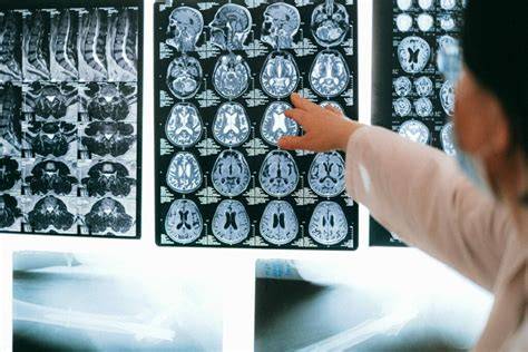 Clinical Neuropsychologist