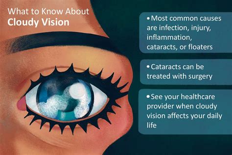 Cloudy Eyesight One Eye