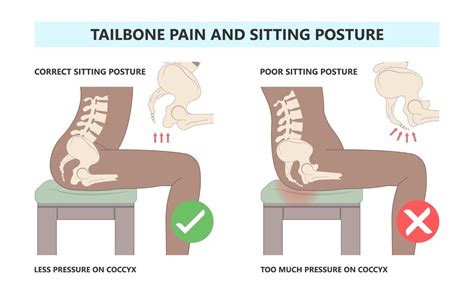 Coccyx Hurts When Sitting